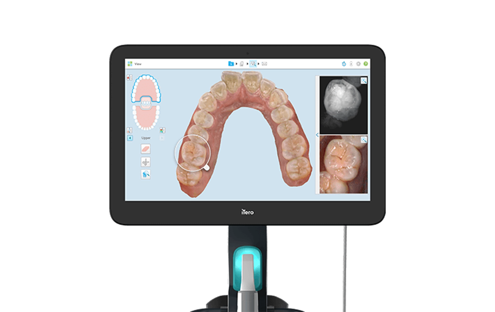 Feature3 最新デジタル技術で、その場で納得 精密で再現性の高い治療を実現します