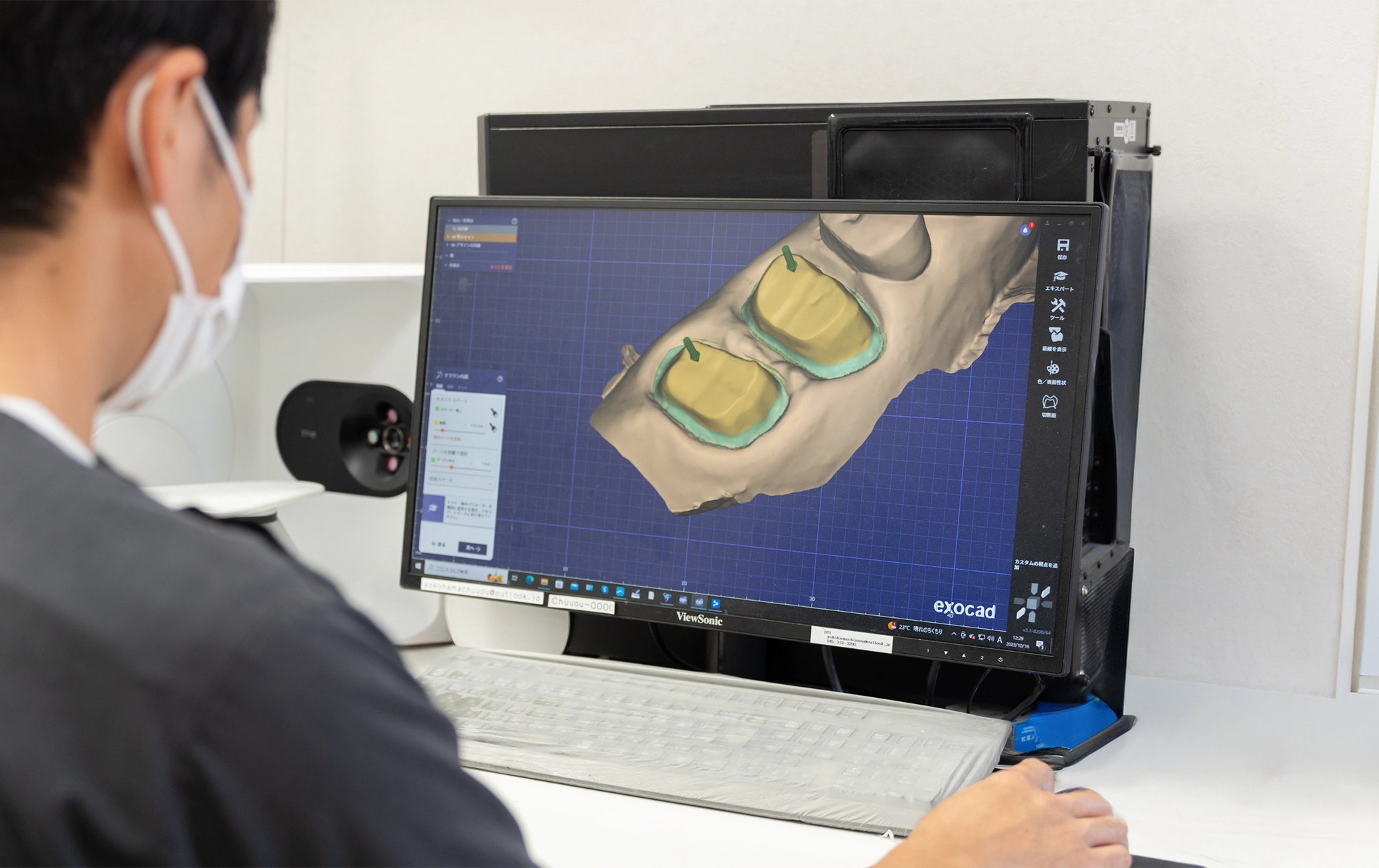 Feature5 院内技工所により治療期間を短縮 その場で調整、治療期間も短縮できます