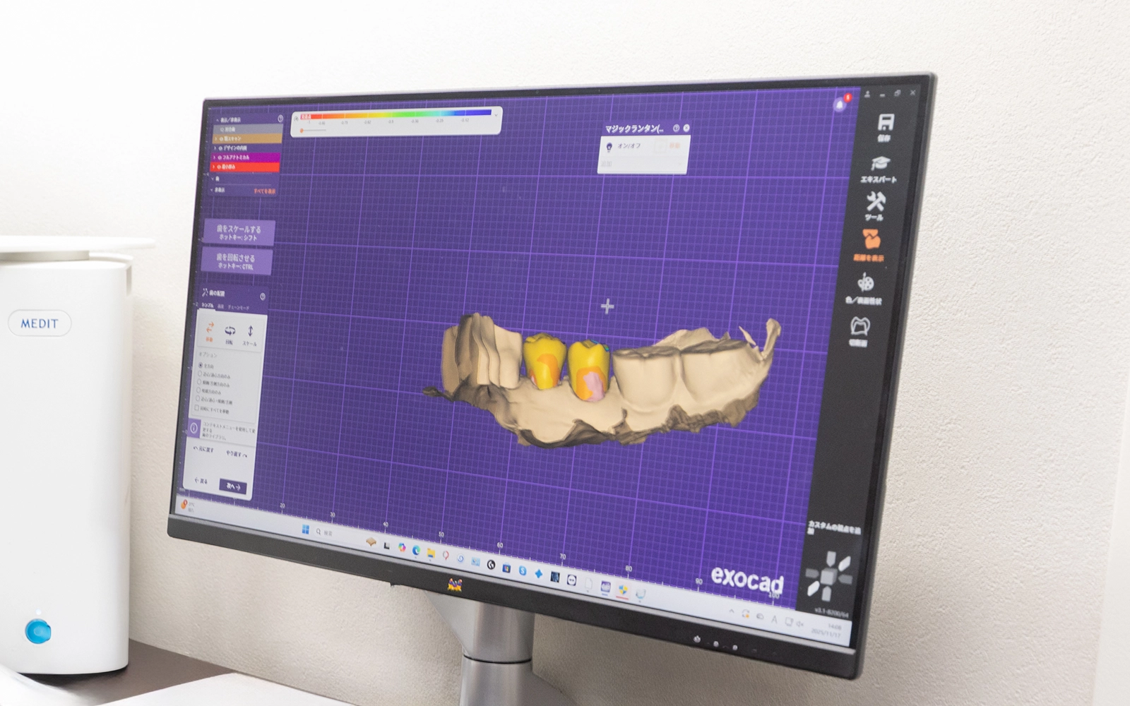 デジタル技術とチーム医療による精度の向上