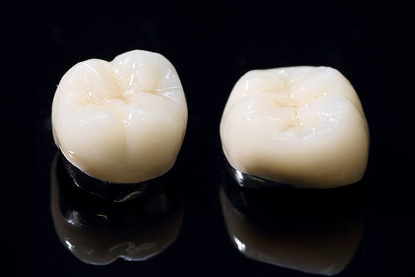 ハイブリッドセラミックス ハイブリッドセラミックス