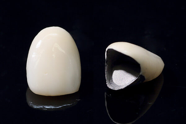 ハイブリッドセラミックス ハイブリッドセラミックス