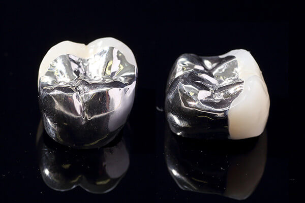 硬質レジン前装冠 硬質レジン前装冠