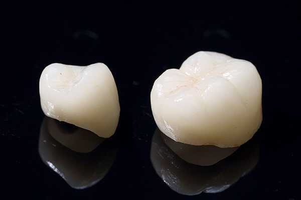 ジルコニアセラミクス ジルコニアセラミクス