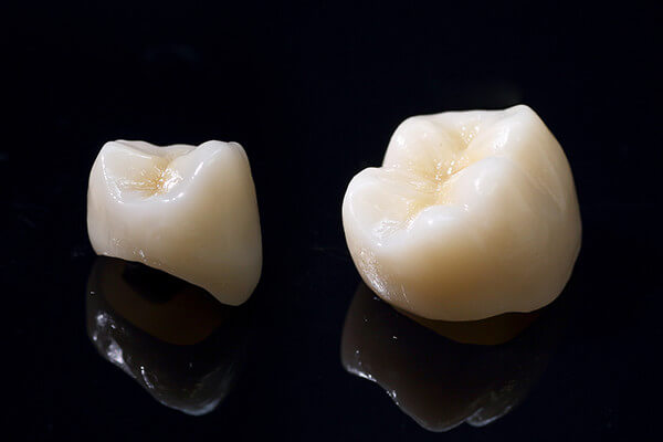 ジルコニアフルカウンター ジルコニアフルカウンター