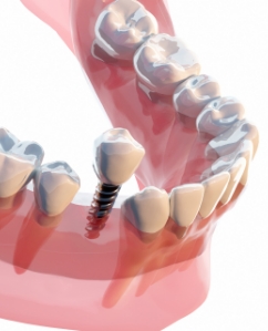 一本からその日で対応します