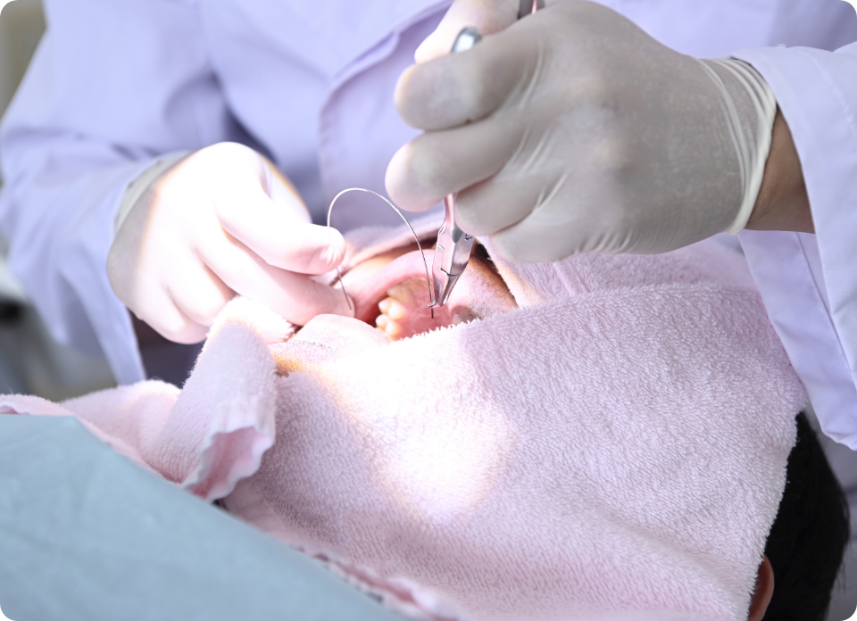 完全オーダーメイドの矯正治療